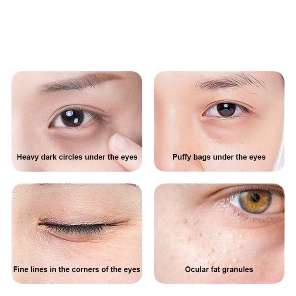 TUA EyePods™